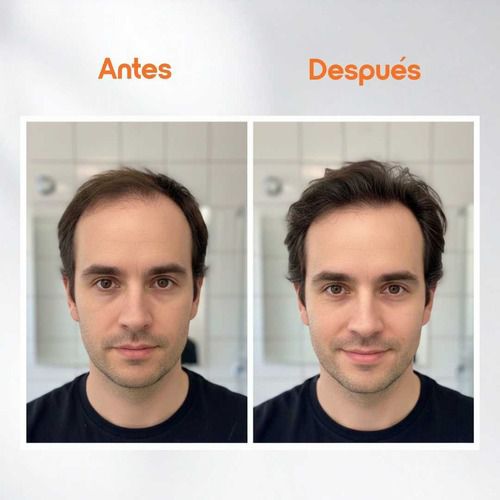 SHAMPOO BASE ALQUITRÁN