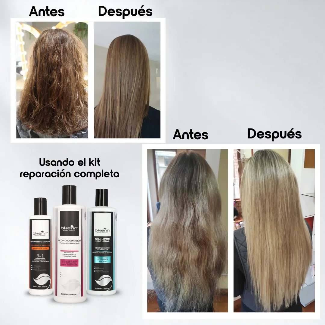 KIT REPARACIÓN COMPLETA