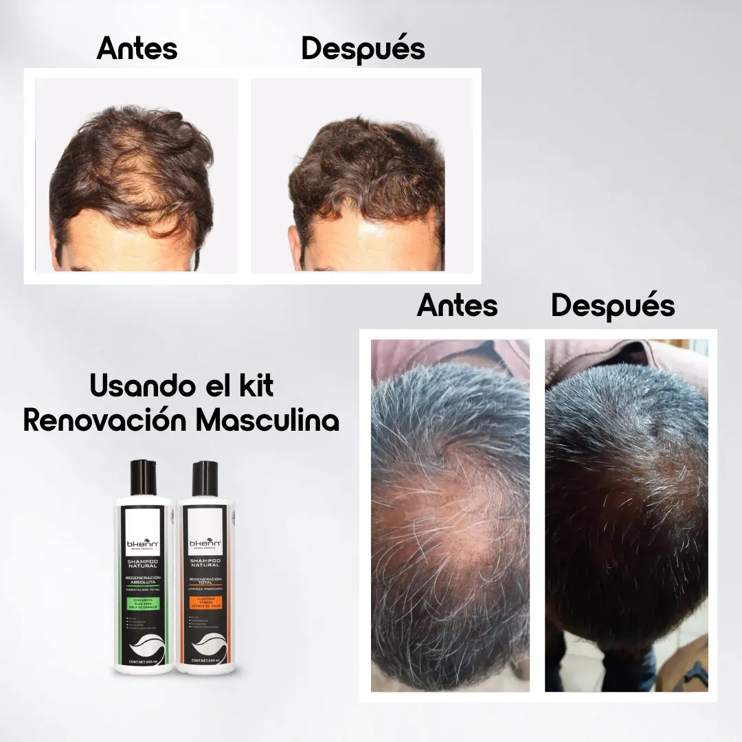 KIT RENOVACIÓN MASCULINA