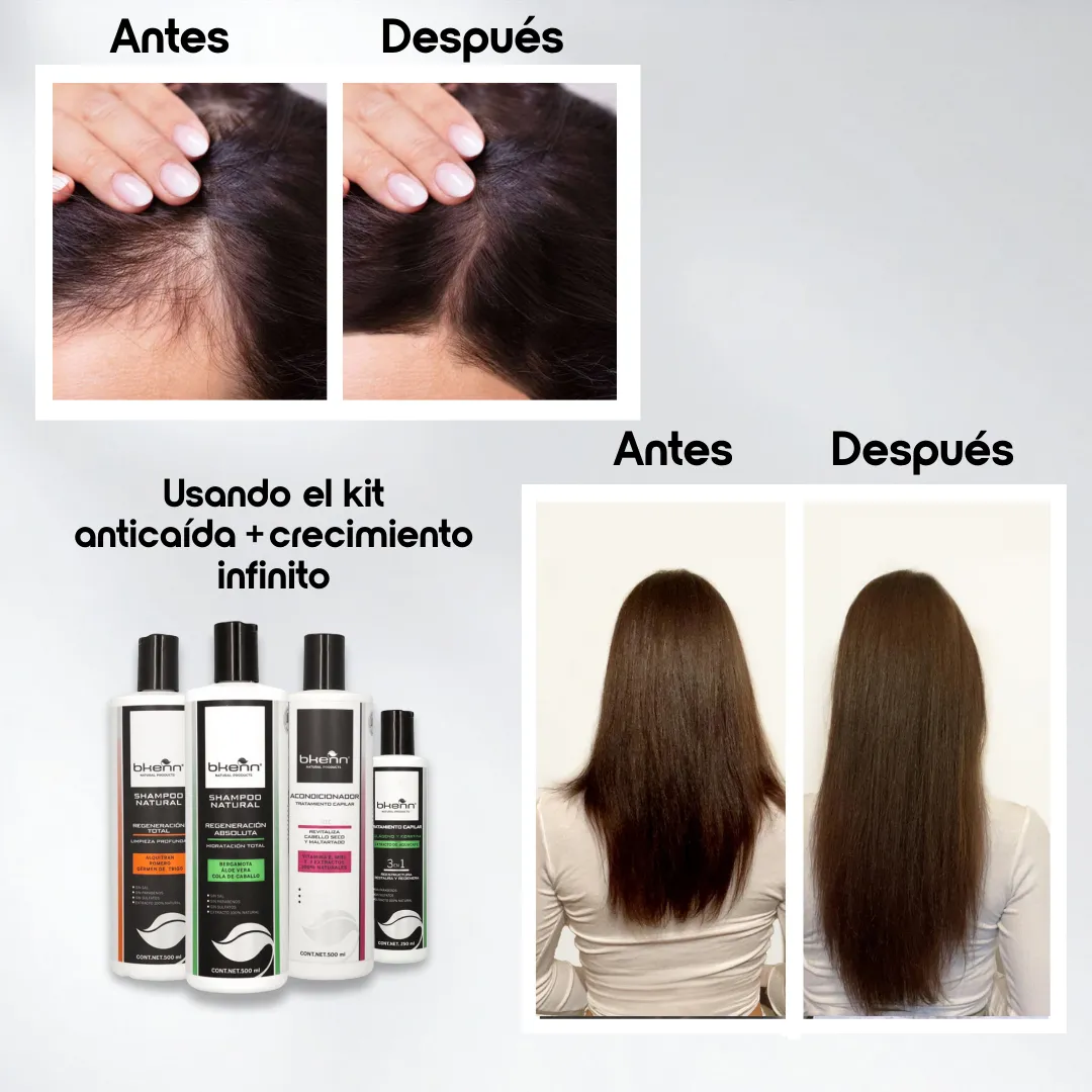 KIT ANTICAIDA + CRECIMIENTO INFINITO