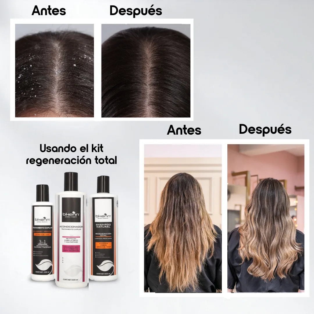 KIT REGENERACIÓN TOTAL